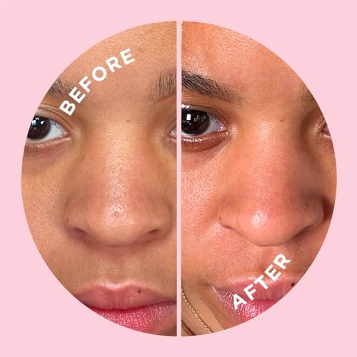 ZitSticka Pimple Patches for Face and Body, Hydrocolloid Patches to Cover Zits & Blemishes, Acne Patches or Zit Spot Stickers, Body Blemish Patch (GOO GETTER BODY PATCH 9 Pack)