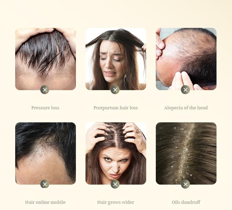 Anti Hair Loss Plant Shampoo, Ginger Plant Extract for Hair Growth,Oil Control, Hair Care for Women,Men (200g/box)