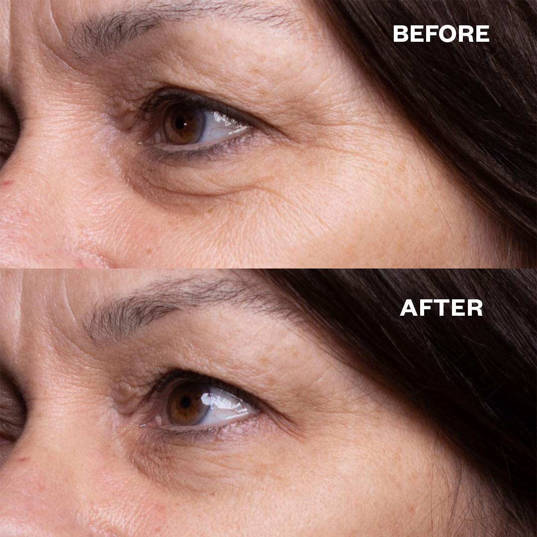 Wrinkles Schminkles Faux-Tox Face Bundle Set: Silicone Patch Cleanser, Forehead Wrinkle Patches & Under Eye Wrinkle Patches