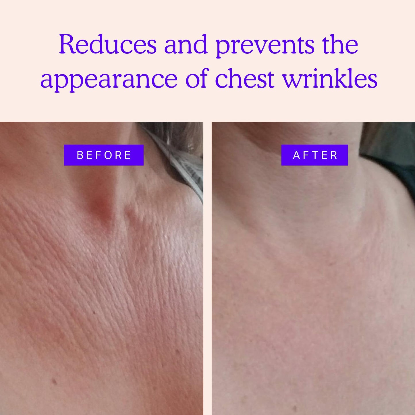 BLUMBODY Face Wrinkle Patch Complete Set, Chest Wrinkle Pad and Neck Wrinkle Pads Set Bundle