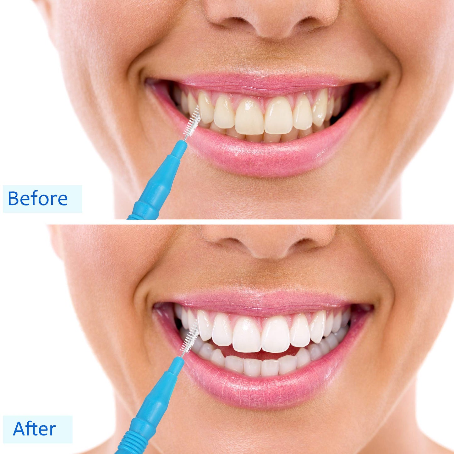 BBTO 100 Pcs Braces Dental Brush Flosser for Cleaner Interdental Brush Toothpick Dental Tooth Flossing Head Oral Dental Toothpick Cleaners Cleaning Tool (Red White Green Light Green, Light Blue)