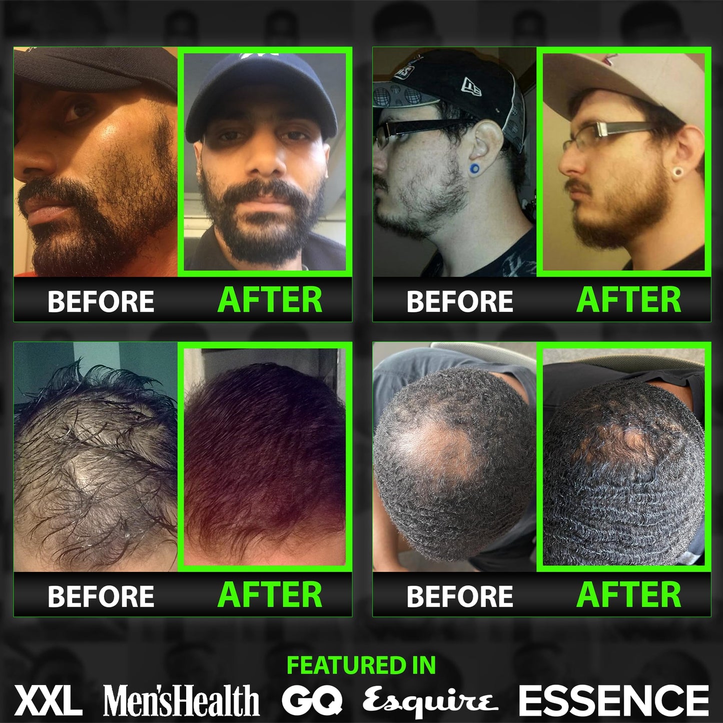 Beard Growth Kit w/ 2X Biotin Beard Balm for Men + GROW Hair & Beard Shampoo (11-in-1 Biotin Shampoo for Men) + GROW Beard Growth Oil for Men BBS USA