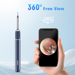 Note5 Ear Wax Tweezers with Camera, Ear Cleaner Camera Otoscope Camera with Light, Real-time Remote Video with Ear Pick & Tweezers, 6 Earwax Removal Kit 12 Spoons Ear Cleaning Set for Whole Family