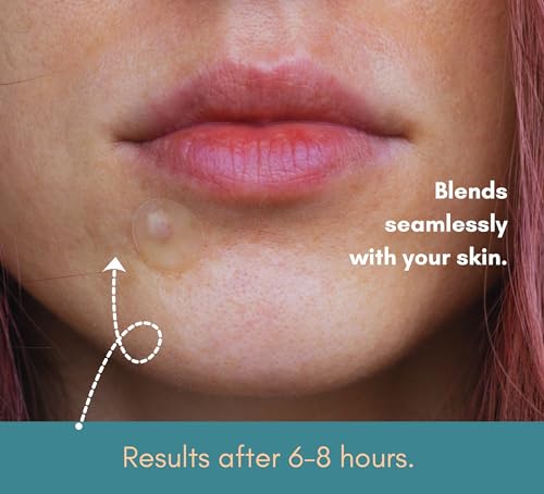 Pimple Patches with Salicylic Acid - Hydrocolloid Invisible Acne Patches - 81 Count 2 Sizes (10mm & 12mm) Korean Zit Patches