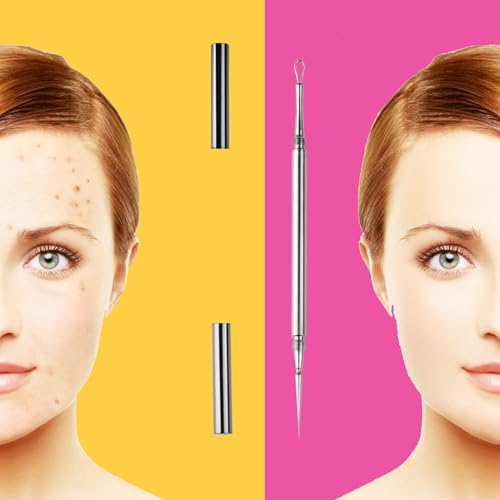 Professional Facial Blackhead Remover Extractor Tool - Double Ended Circle Loop & Sharp Needle Pimple Popper Tool - 2-in-1 Blackhead & Blemish Remover - Zit and Pimple Acne Removal(1 Pack)