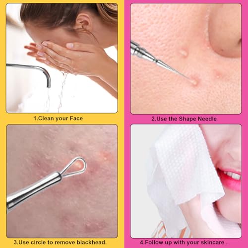 Professional Facial Blackhead Remover Extractor Tool - Double Ended Circle Loop & Sharp Needle Pimple Popper Tool - 2-in-1 Blackhead & Blemish Remover - Zit and Pimple Acne Removal(1 Pack)