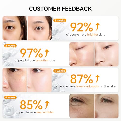 Vitamin C Serum for Face, BREYLEE Vitamin C Facial Serum, Moisturizing Face Serum, Anti Aging Serum for Skin Care, Brightening Skin with Hyaluronic Acid, Vitamin E, Retinol, 0.6 Fl Oz