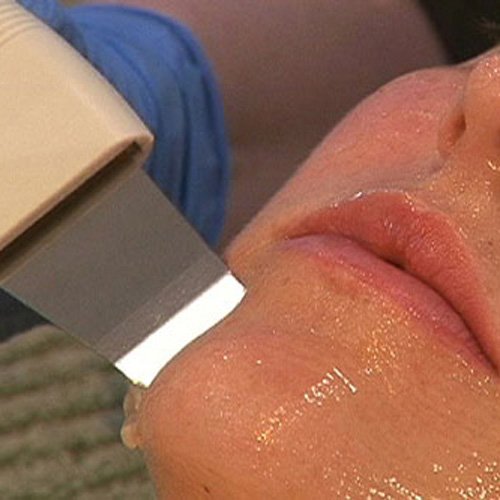 The Ultimate Ultrasonic Facial - The Best Esthetician Video on Ultrasound & Ultrasonic Skin Care - Comprehensive Beauty Course Training DVD By Award-Winning Aesthetician Malinda McHenry - Learn How To Do a Facial with Ultrasound Facial Equipment