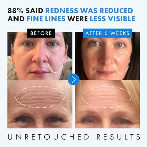 𝗧𝗢𝗣 𝟮𝟬𝟮𝟯* Hyaluronic Acid Face Serum - 2.5% Pure Hyaluronic Serum + 3% B5, Anti Wrinkle + Anti Aging Serum for Face with Vitamin C & E, Aloe - Antiaging Hydrating Serum, Hylunaric Acid Serum