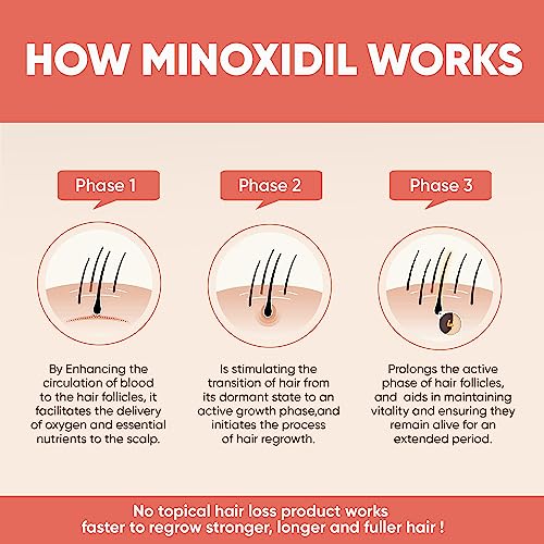 Vocks 5% Minoxidil for Women Hair Growth Treatment - Extra Strength - Clinically Proven - Unscented Foam - Anti Hair Loss and Promotes Thicker Fuller Hair - 4 Month Supply