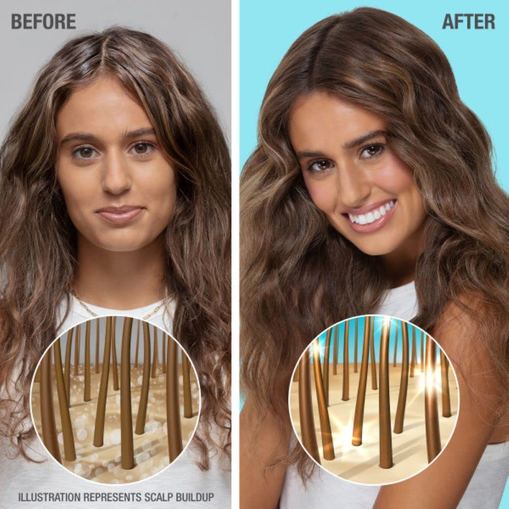 Neutrogena Moisturizing Healthy Scalp Hydro Boost Conditioner for Dry Hair and Scalp, with Hydrating Hyaluronic Acid, pH-Balanced, Paraben & Phthalate-Free, Color-Safe, 12 Fl Oz (pack of 3)