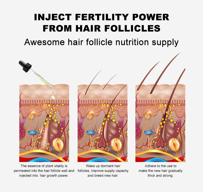 Vedora King of Ginger Oil for Hair Growth - Biotin Hair Growth Serum, 100% Pure Natural Ginger Essential Oil - Promotes Stronger, Thicker, Longer Hair in Women & Men - 3.15 Fl Oz / 90ML (3 PCS)