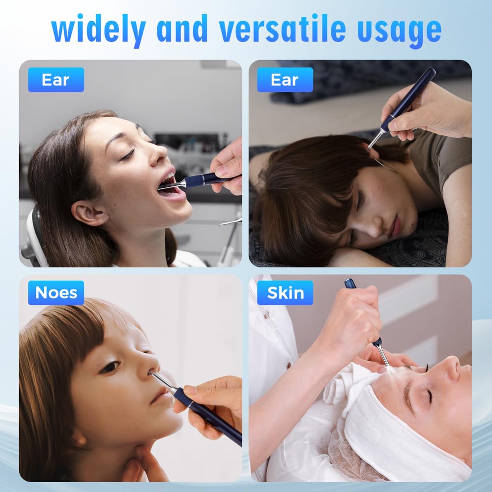 Note5 Ear Wax Tweezers with Camera, Ear Cleaner Camera Otoscope Camera with Light, Real-time Remote Video with Ear Pick & Tweezers, 6 Earwax Removal Kit 12 Spoons Ear Cleaning Set for Whole Family