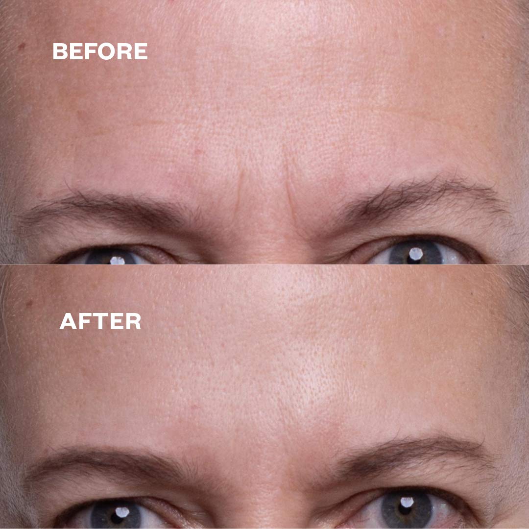 Wrinkles Schminkles Faux-Tox Face Bundle Set: Silicone Patch Cleanser, Forehead Wrinkle Patches & Under Eye Wrinkle Patches