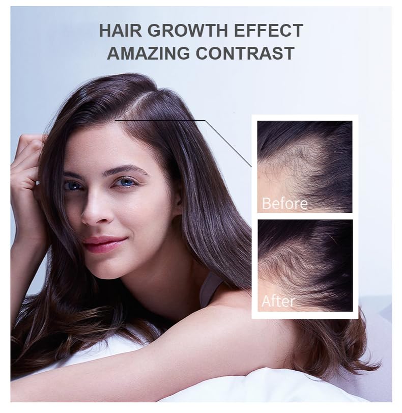 Vedora King of Ginger Oil for Hair Growth - Biotin Hair Growth Serum, 100% Pure Natural Ginger Essential Oil - Promotes Stronger, Thicker, Longer Hair in Women & Men - 3.15 Fl Oz / 90ML (3 PCS)