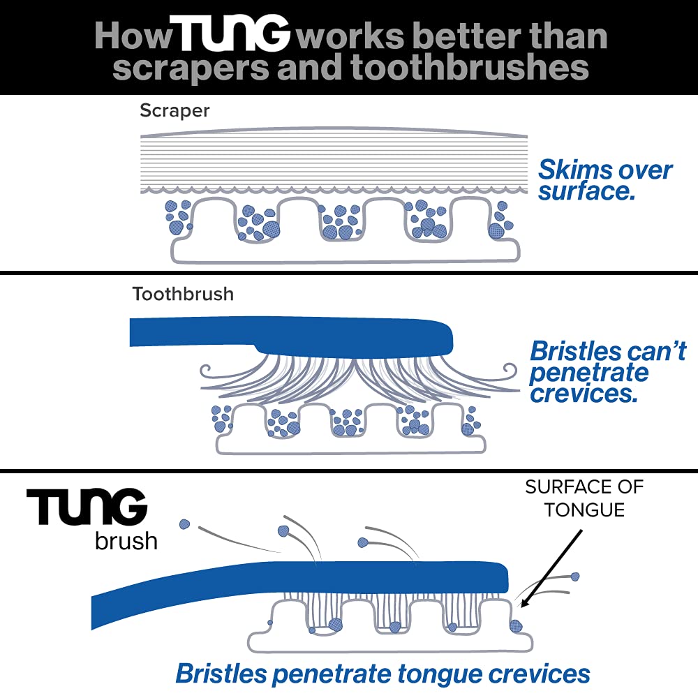Tung Tongue Brush & Gel Kit | Tongue Cleaner for Adults | Tongue Scraper to Fight Bad Breath and Halitosis | Mouth Odor Eliminator | Fresh Mint | Made in America (Set of 1)