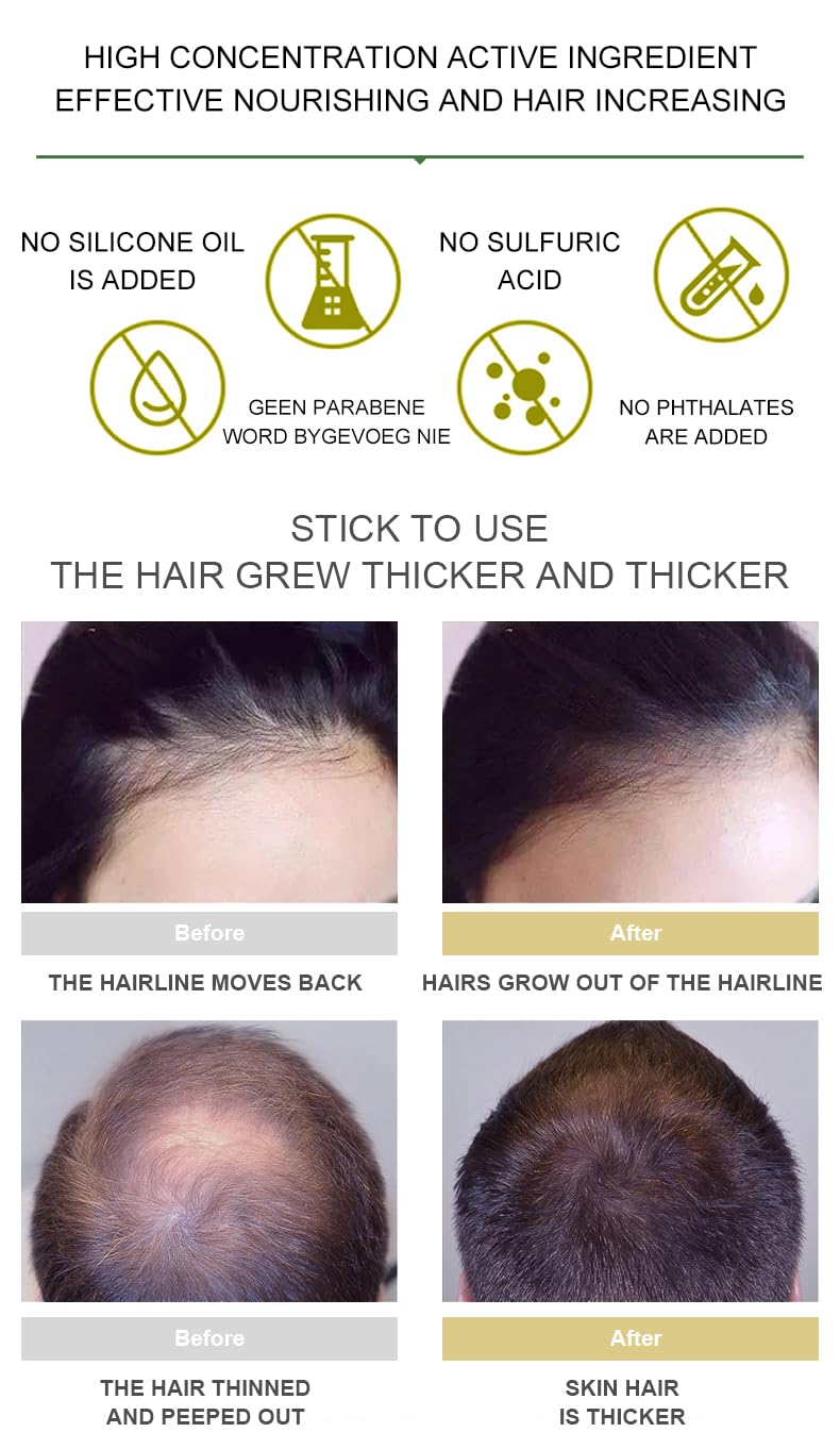 Vedora King of Ginger Oil for Hair Growth - Biotin Hair Growth Serum, 100% Pure Natural Ginger Essential Oil - Promotes Stronger, Thicker, Longer Hair in Women & Men - 3.15 Fl Oz / 90ML (3 PCS)