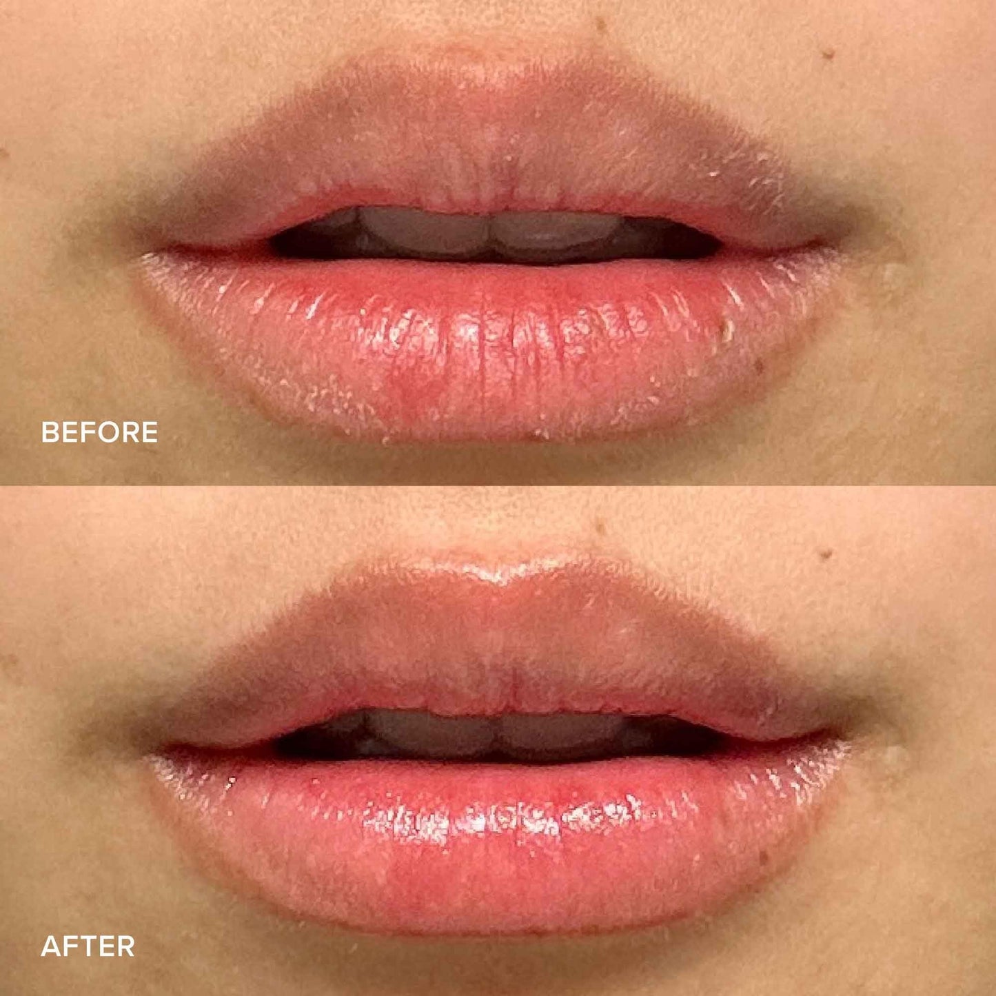 Alpyn Skin + Lip Rescue Set | PlantGenius Melt Moisturizer | Willow & Sweet Agave Plumping Lip Mask