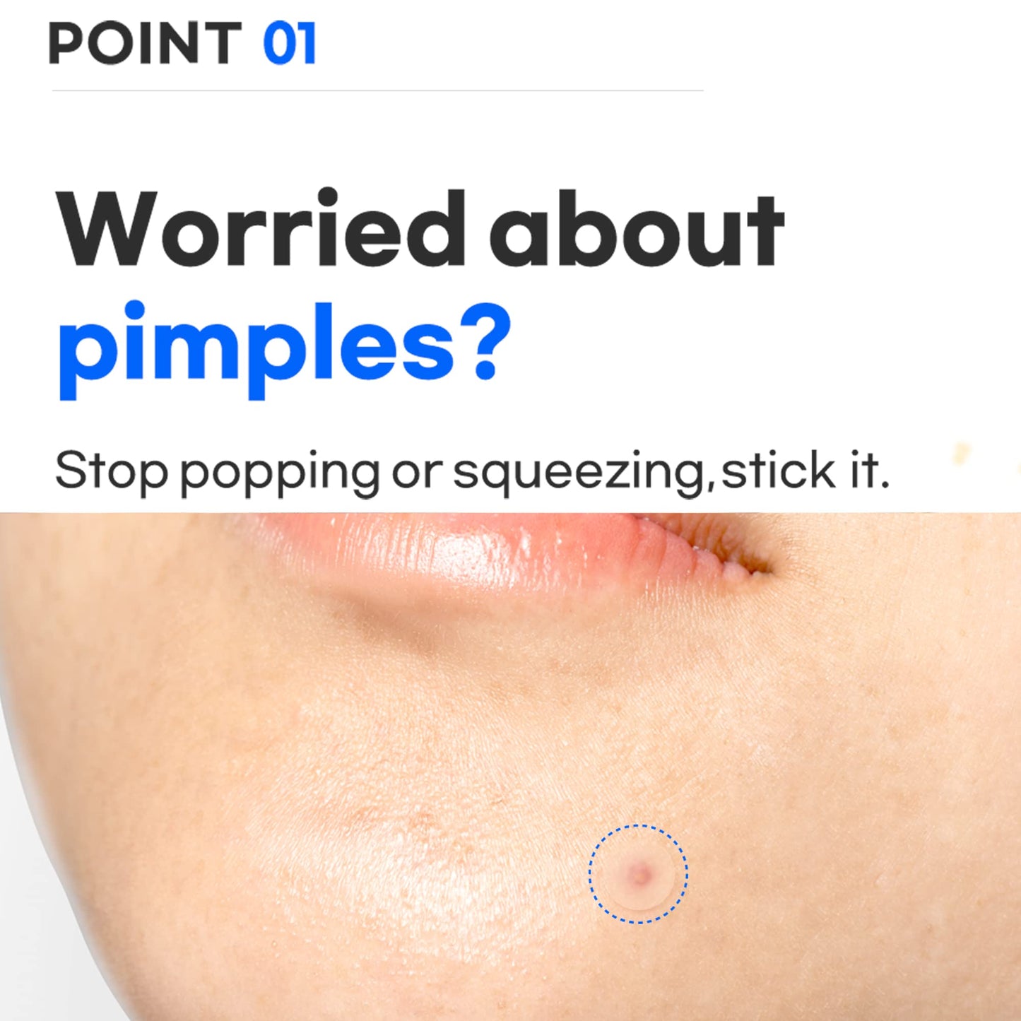 TIAM Surprise B Patch (24 Count, Pack of 1), Hydrocolloid Acne Patches for Acne Treatment, Pimple Patch for Face, Acne Pimple Patch