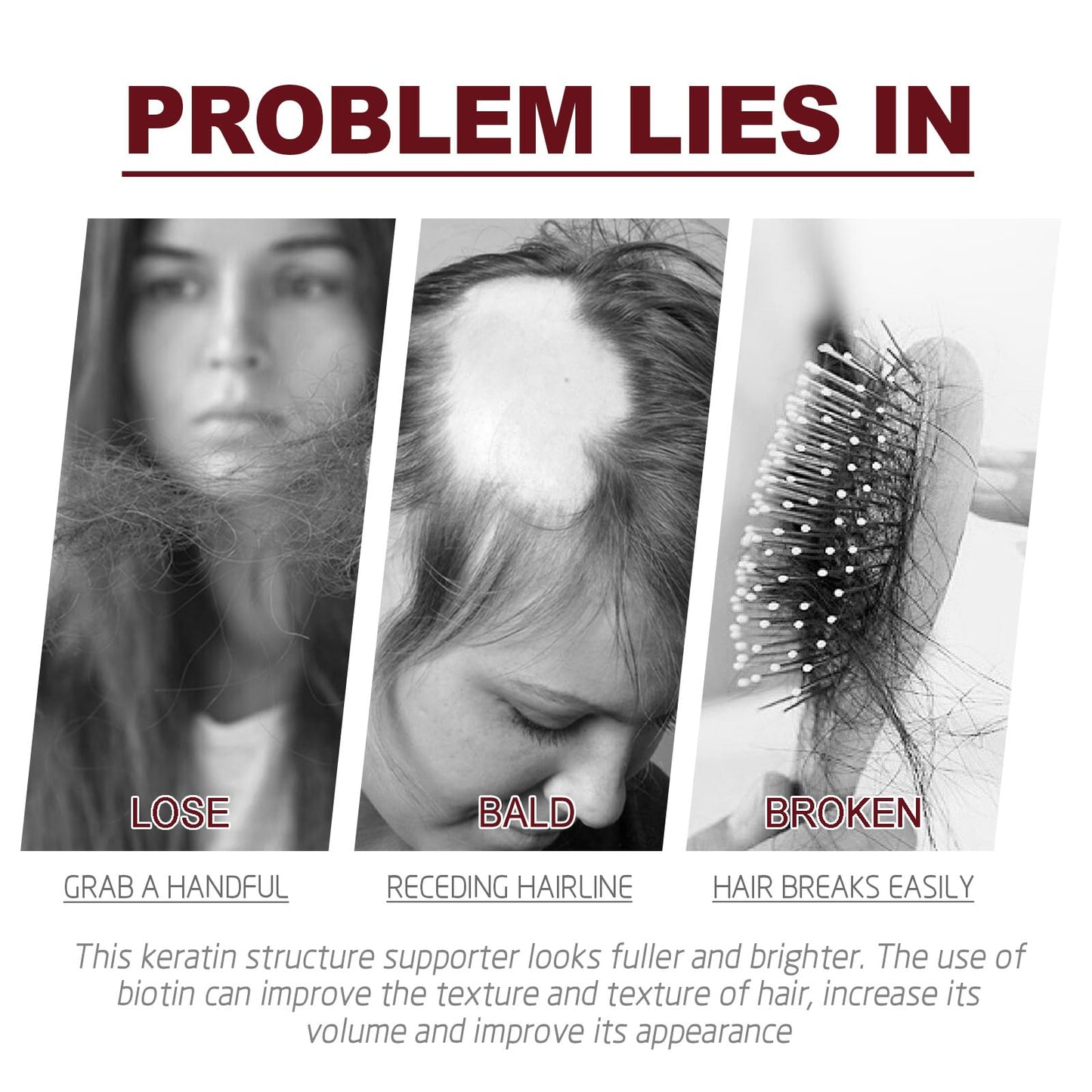 Anti Hair Loss Plant Shampoo, Ginger Plant Extract for Hair Growth,Oil Control, Hair Care for Women,Men (200g/box)