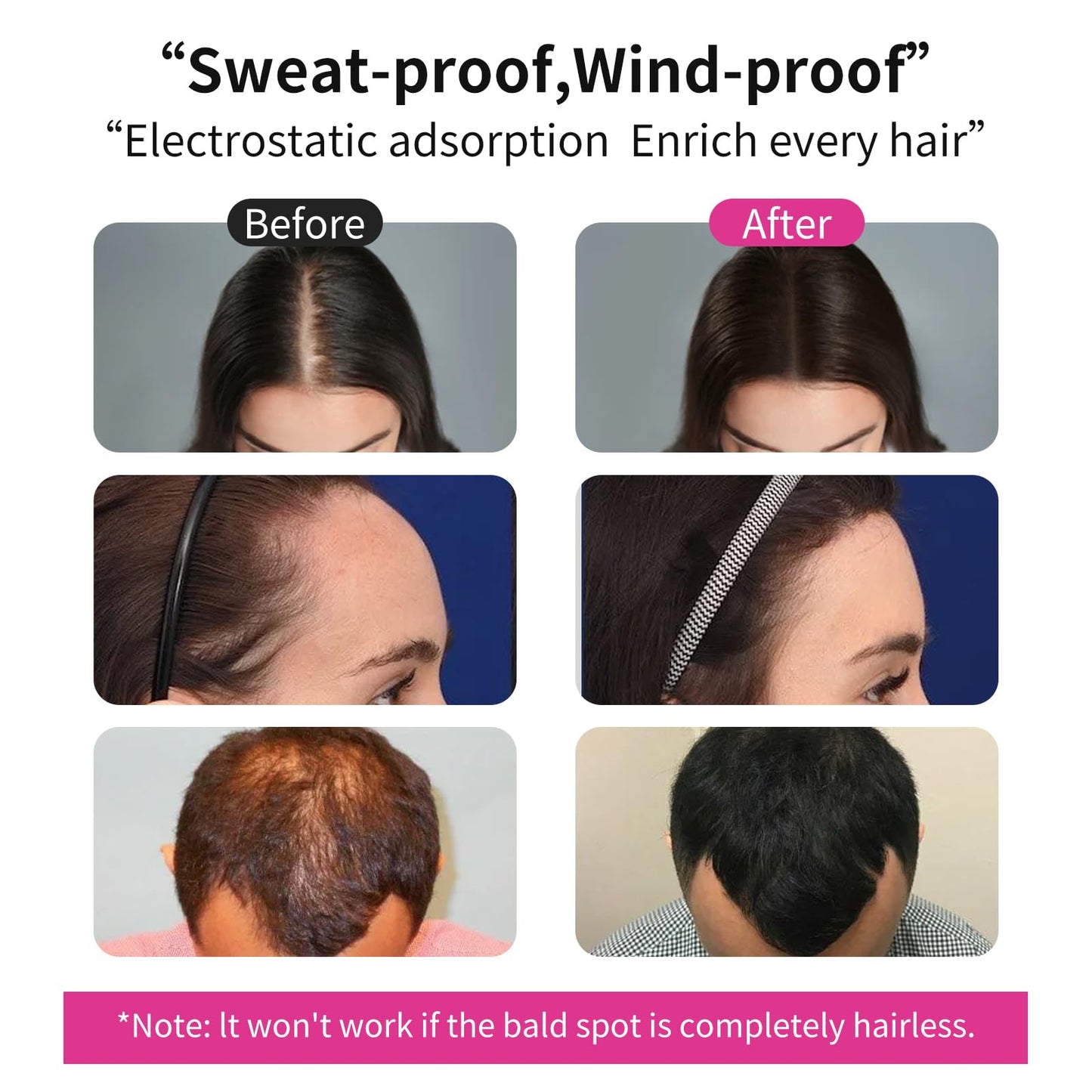 SEVICH Hair Fibers for Thinning Hair, Hair Building Fibers Instantly Thicker & Fuller Look,Hair Powder for Men & Women 100g Blonde