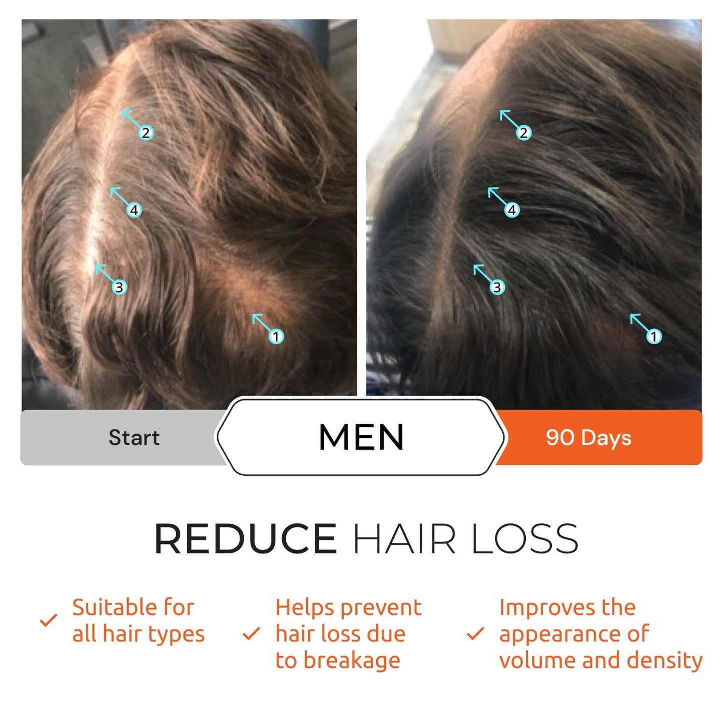 Revita Shampoo and Revita Tablets to Support Hair Growth Bundle, Packaging May Vary