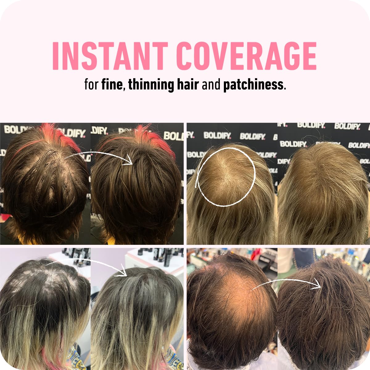 Boldify Thickening Spray + Hair Fiber (Dark Brown) + Shampoo Thicken Up Bundle: Volume, Root Lift, Texture for Thinning Hair