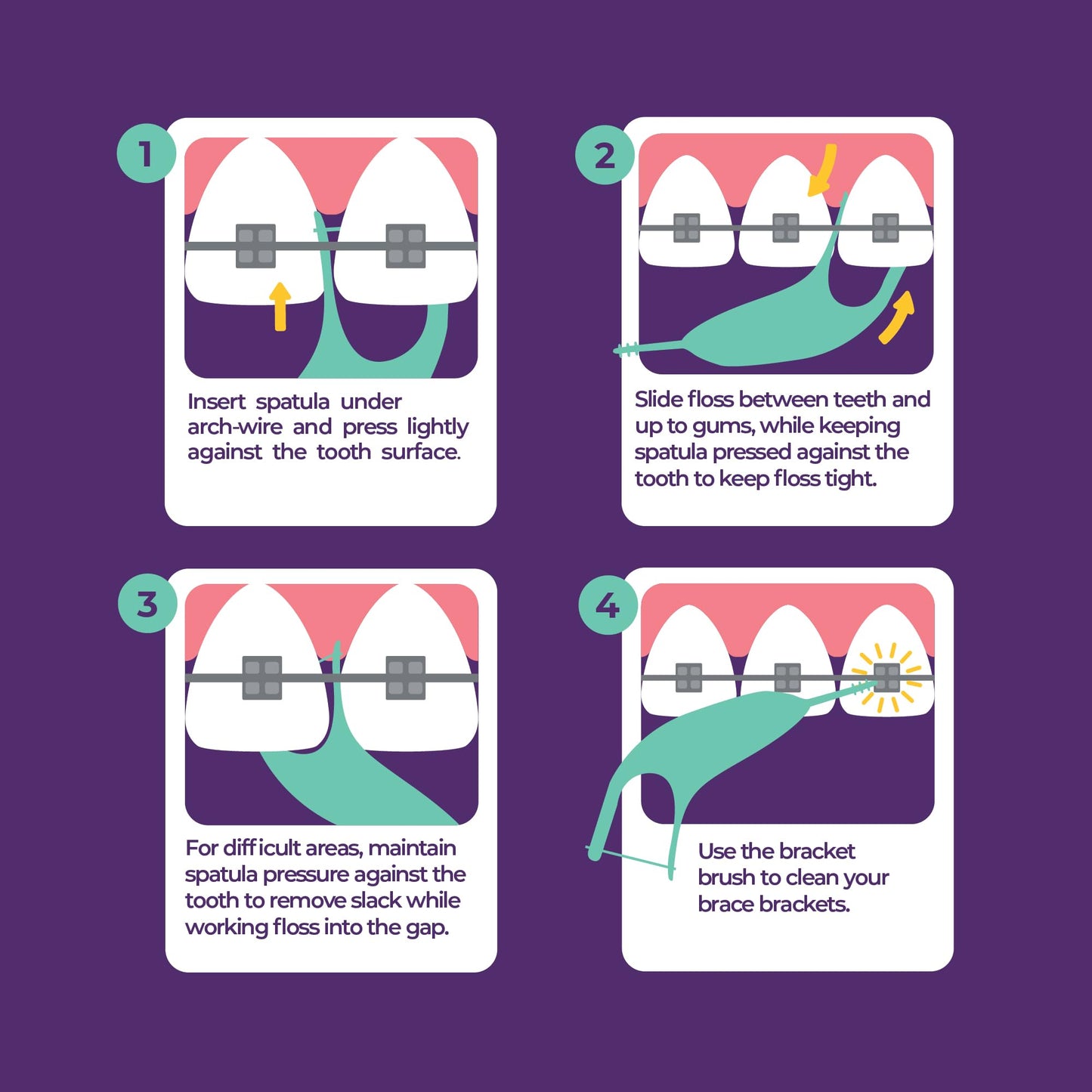 Platypus Orthodontic Flossers for Braces | Ortho Picks for Adults & Kids | Fits Under Arch Wire | Non-Damaging | Encourage Flossing Habits | Floss Teeth in Under Two Minutes (40 Count (Pack of 4))