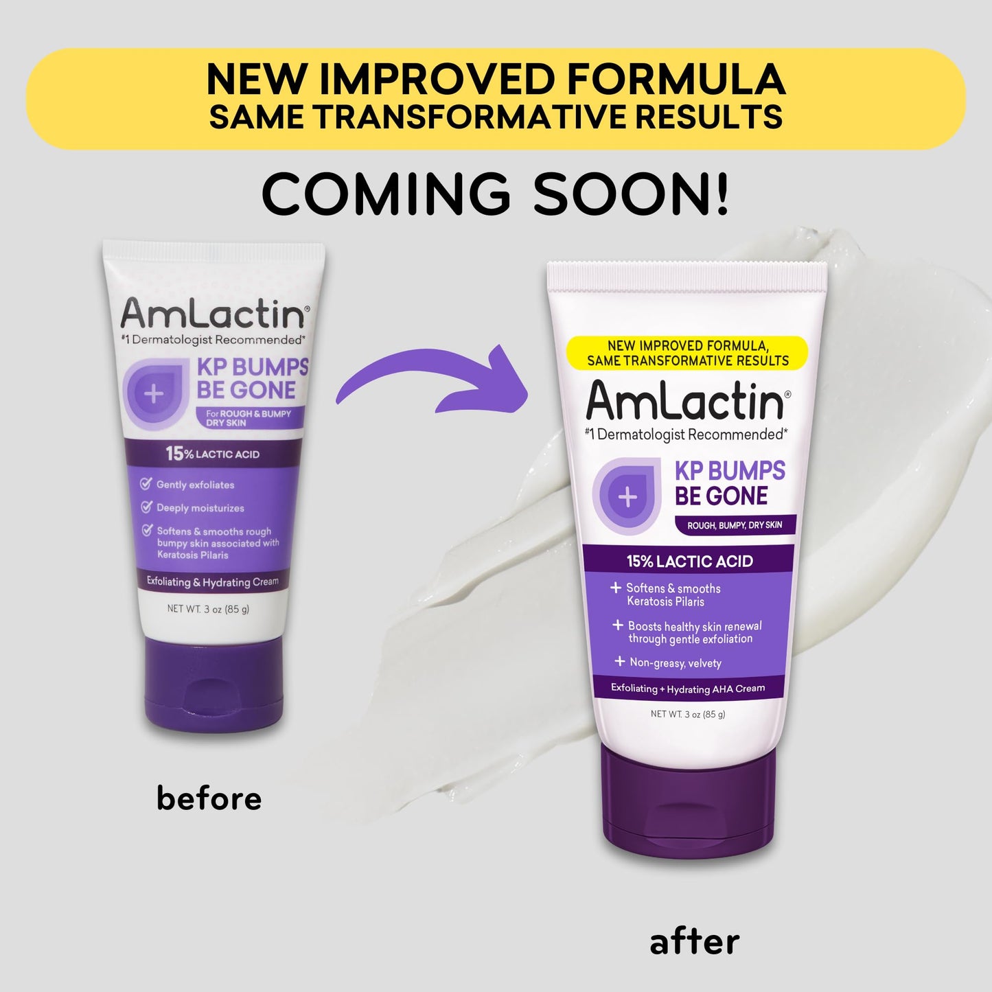 AmLactin KP Bumps Be Gone - 3 oz Keratosis Pilaris Moisturizing Cream with 15% Lactic Acid - Exfoliator and Moisturizer for Dry, Rough and Bumpy Skin (Packaging May Vary)