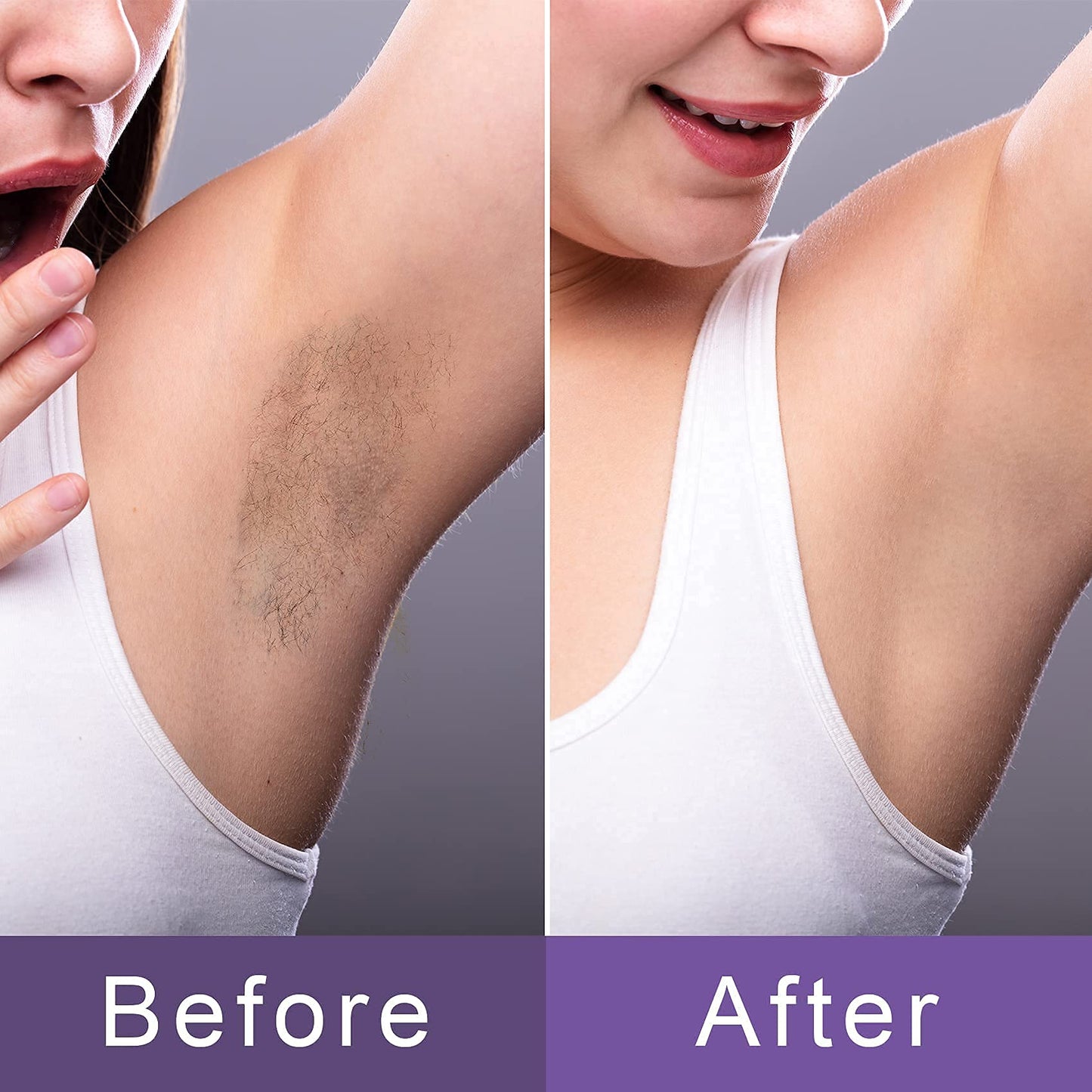 PAGOW Hair Remover Refill Pads, 100pcs Smooth Away Replacement Pads for Leg, Bikini, Facial, Armpit Depilation Tool (50 pcs/size, 2 Different Sizes)