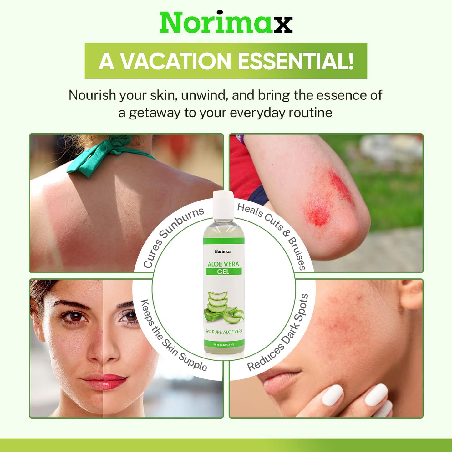 Norimax Natural Aloe Vera Gel for Hair, Scalp, Face, Dry Skin, Sunburn, & Sensitive Skin - Cold Pressed, Vegan, Unscented - Soothing Aloe Face Moisturizer (10 oz.)