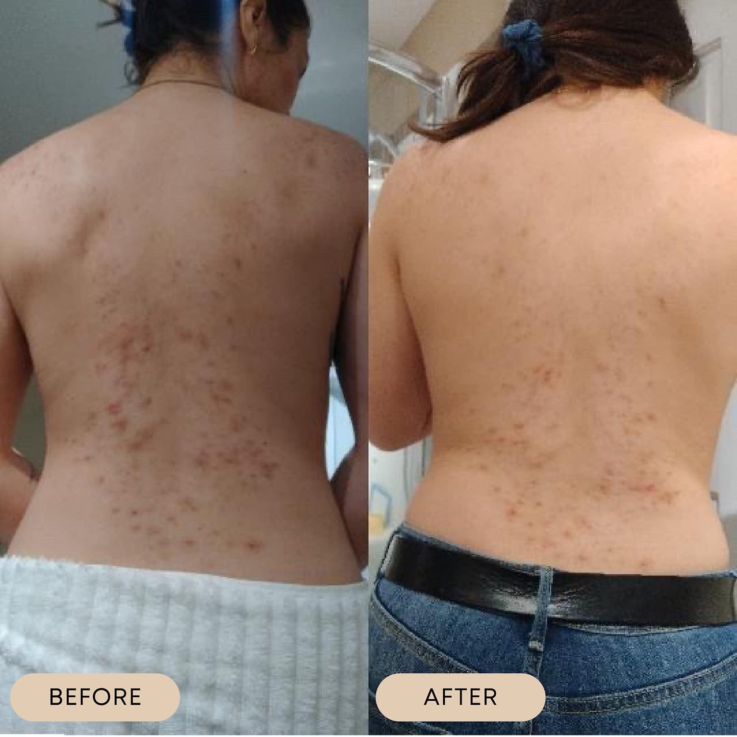 Bushbalm Nude to Prevent Ingrown Hairs, Bushbalm Bermuda to Remove Dark Spots and Bushbalm Sweet Escape to Rejuvenate Dull Skin - Exfoliating Scrub for Soft and Glowing Skin, 236 ml each