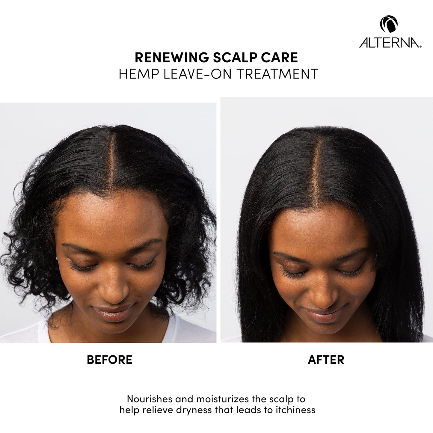 Alterna Renewing Scalp Care Scrub to Foam Scalp Scrub and Hemp Treatment Soothing Scalp Regimen Set | Moisturize, Calm & Soothe Scalp | Vegan
