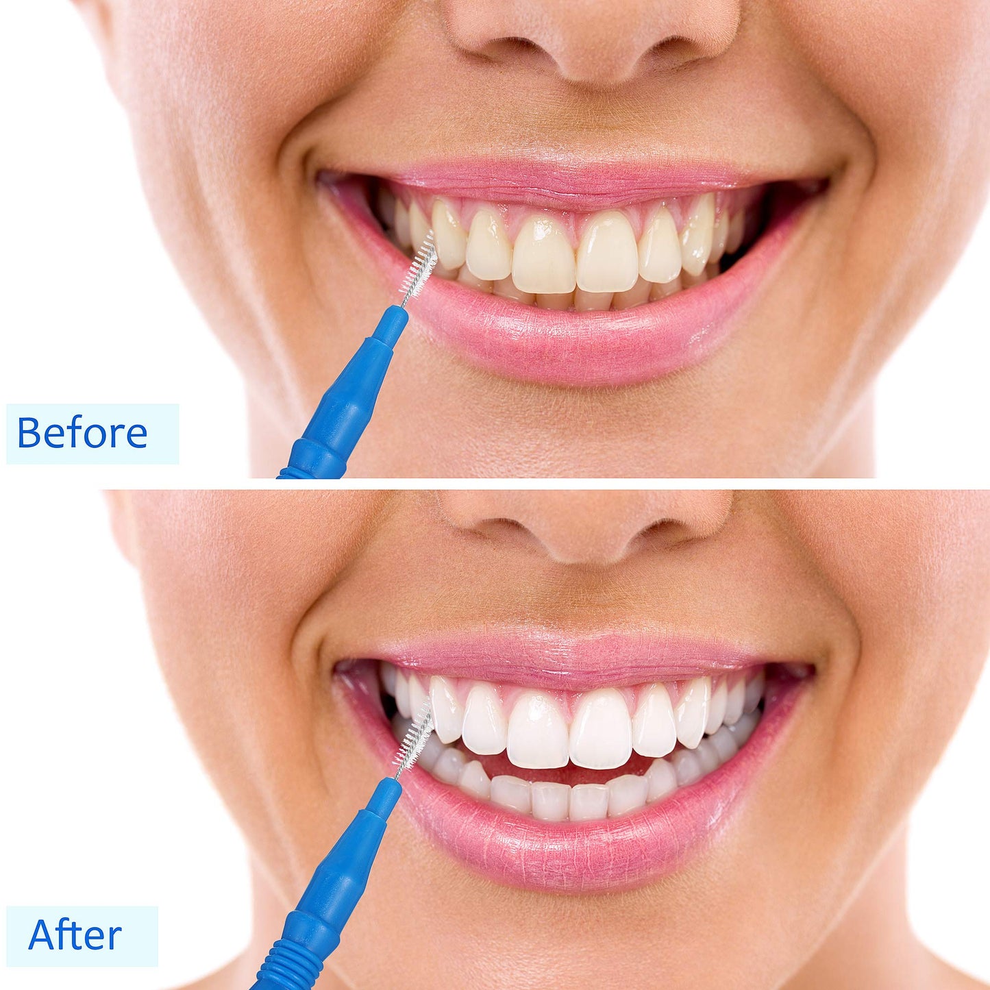 BBTO 100 Pcs Braces Dental Brush Flosser for Cleaner Interdental Brush Toothpick Dental Tooth Flossing Head Oral Dental Toothpick Cleaners Cleaning Tool (Red, Blue, Green, Light Green, Orange)