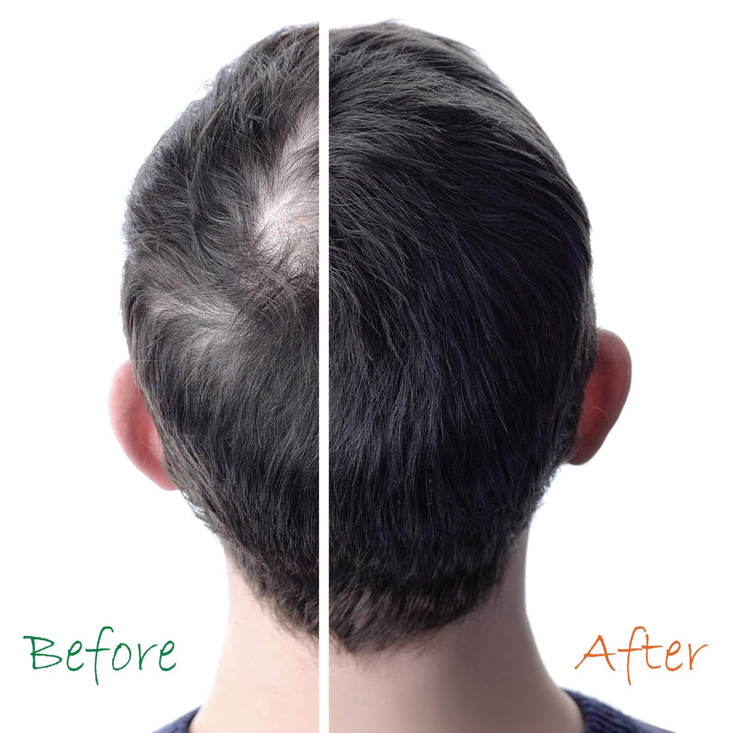 Organic Hair Energizer Pro Vitamin-B5 Hair Growth Booster, 6 fl oz (Pack of 4) DHT-Blocker, Sulfate-Free & Paraben-Free - for Thinning & Receding Hair - Color Safe for Men, Women & Teens