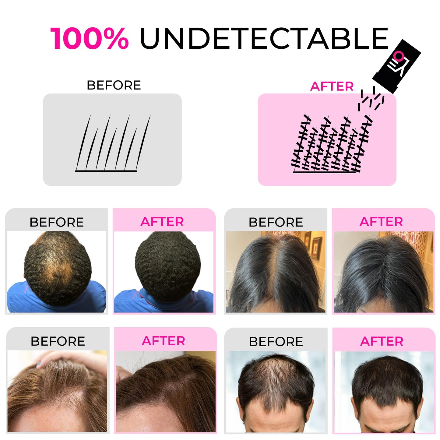 VELO Hair Building Fibers for Thinning Hair, 30g Fill in Fine, Instantly Thicker & Fuller Look, Hair Thickening Fiber, Conceals Hair Loss, Hair Powder for Women & Men, Long Lasting Formula (WHITE)