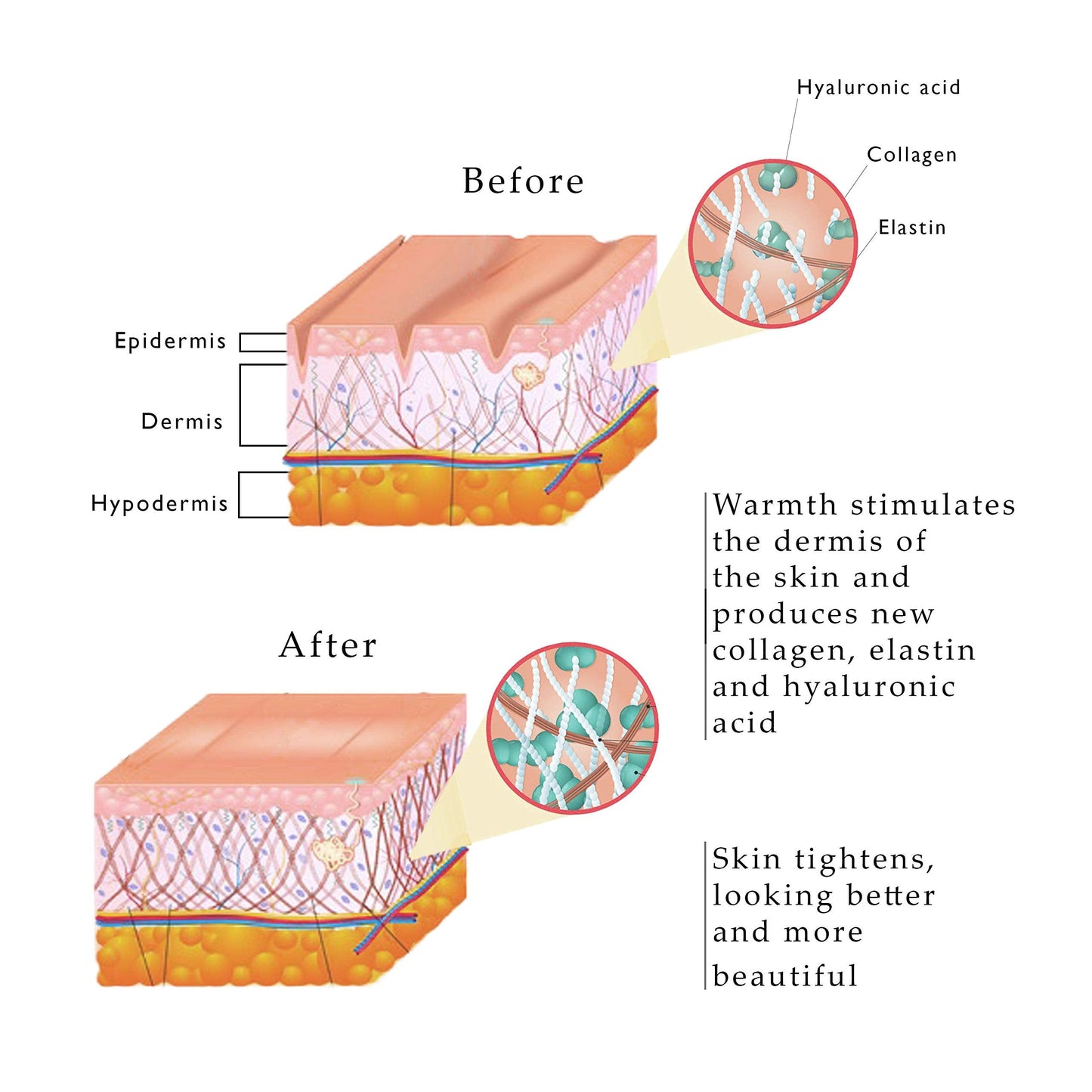 Aphrona Skin Massage Machine I Hot Skin Care I at-Home Beauty Machine