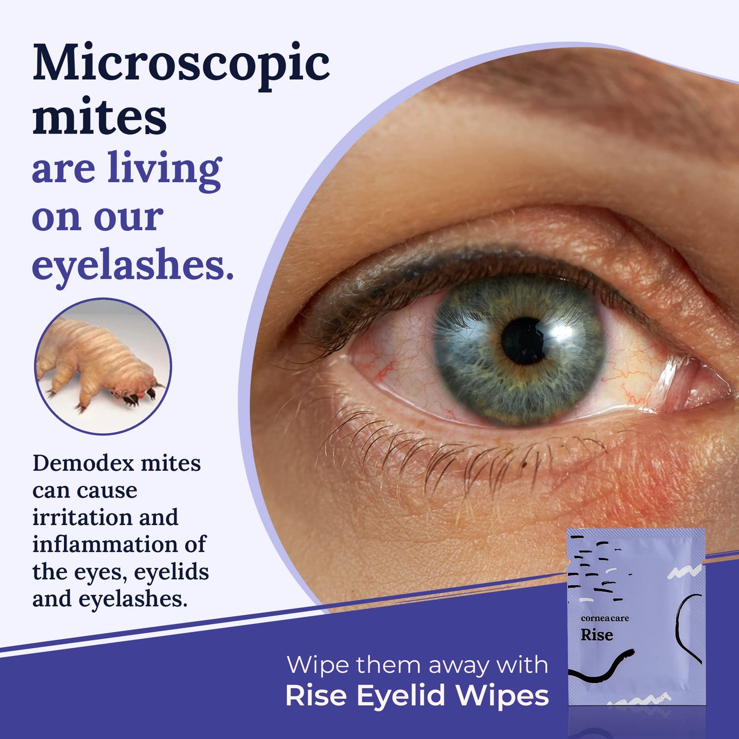 The Eyelid Hygiene Foundation | Self Heating Warm Compress for Eyes | Eye Wipes for Dry Eyes | Eye Compress for Puffy Eyes | Eye Mask for Fast Relief of Dry Eyes | Eyelid Wash Pads | Travel Friendly